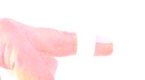 Mallet Splint